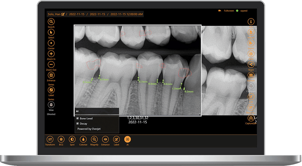 Apteryx XVWeb | Advanced Dental Imaging Software by Planet DDS
