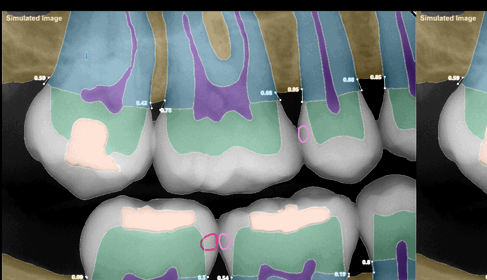The most advanced dental imaging AI analysis.